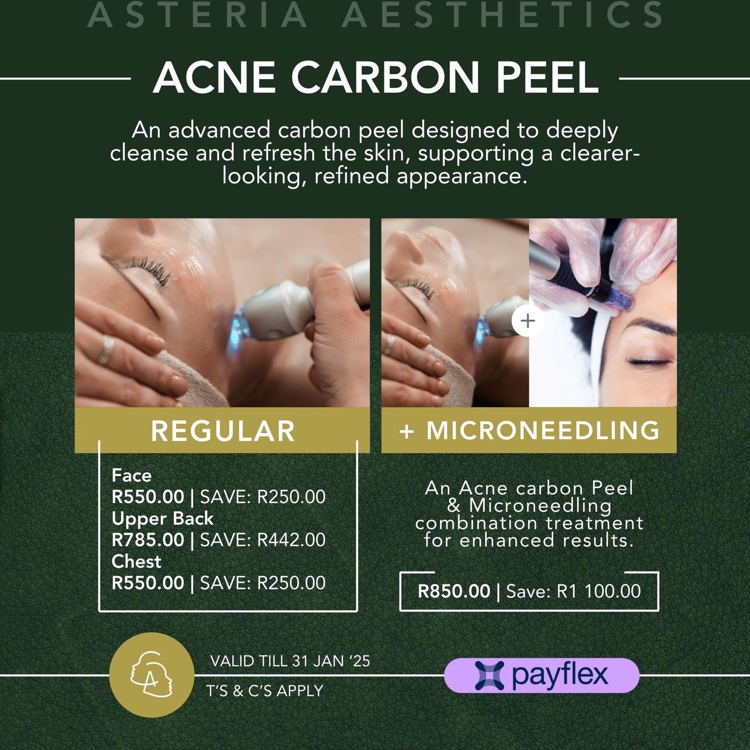 Carbon Peeling Laser Treatment Face