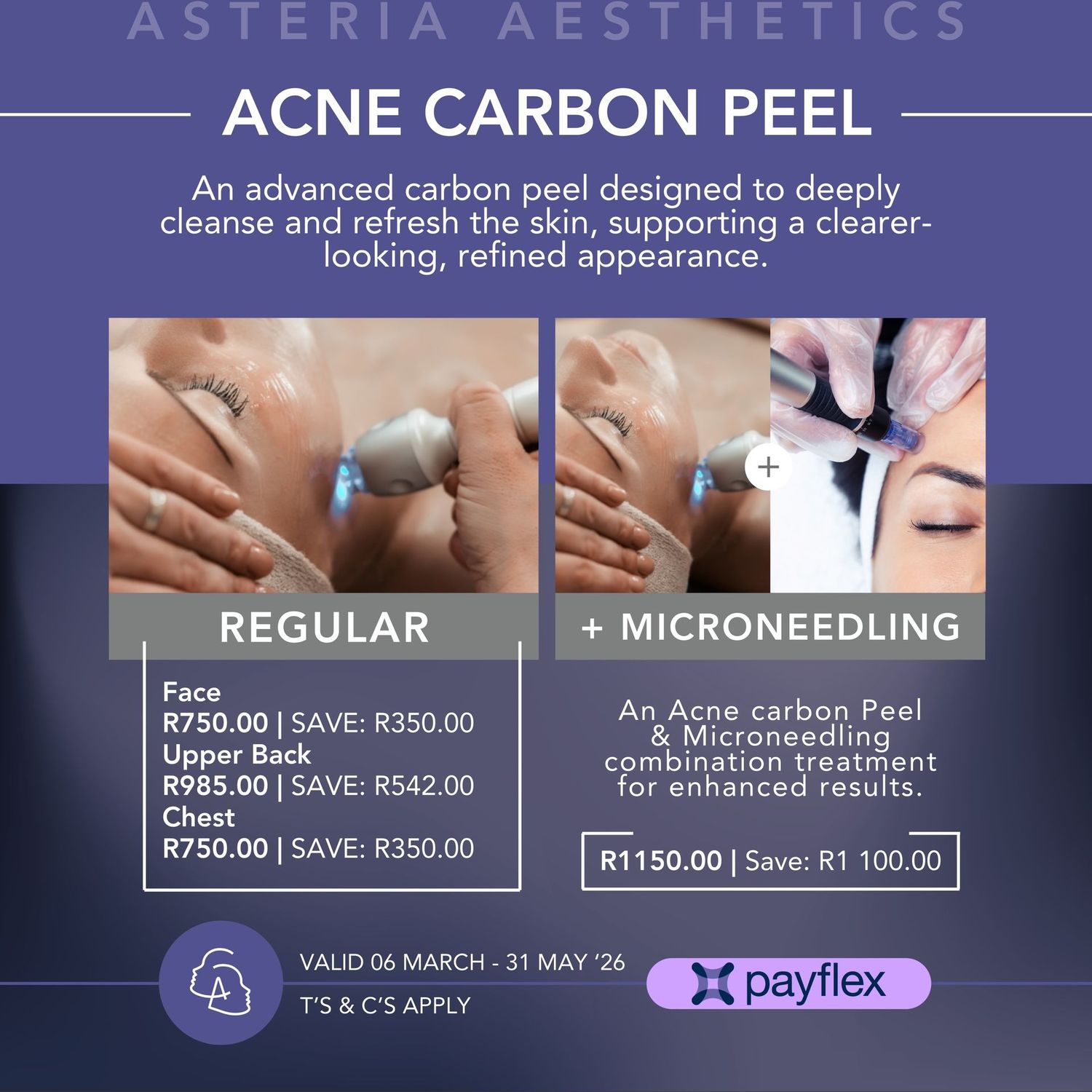 Carbon Peeling Laser Treatment Face