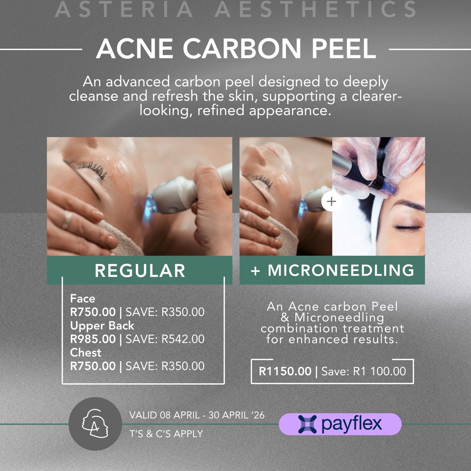 Acne Carbon Peeling Laser Treatment Upper Back