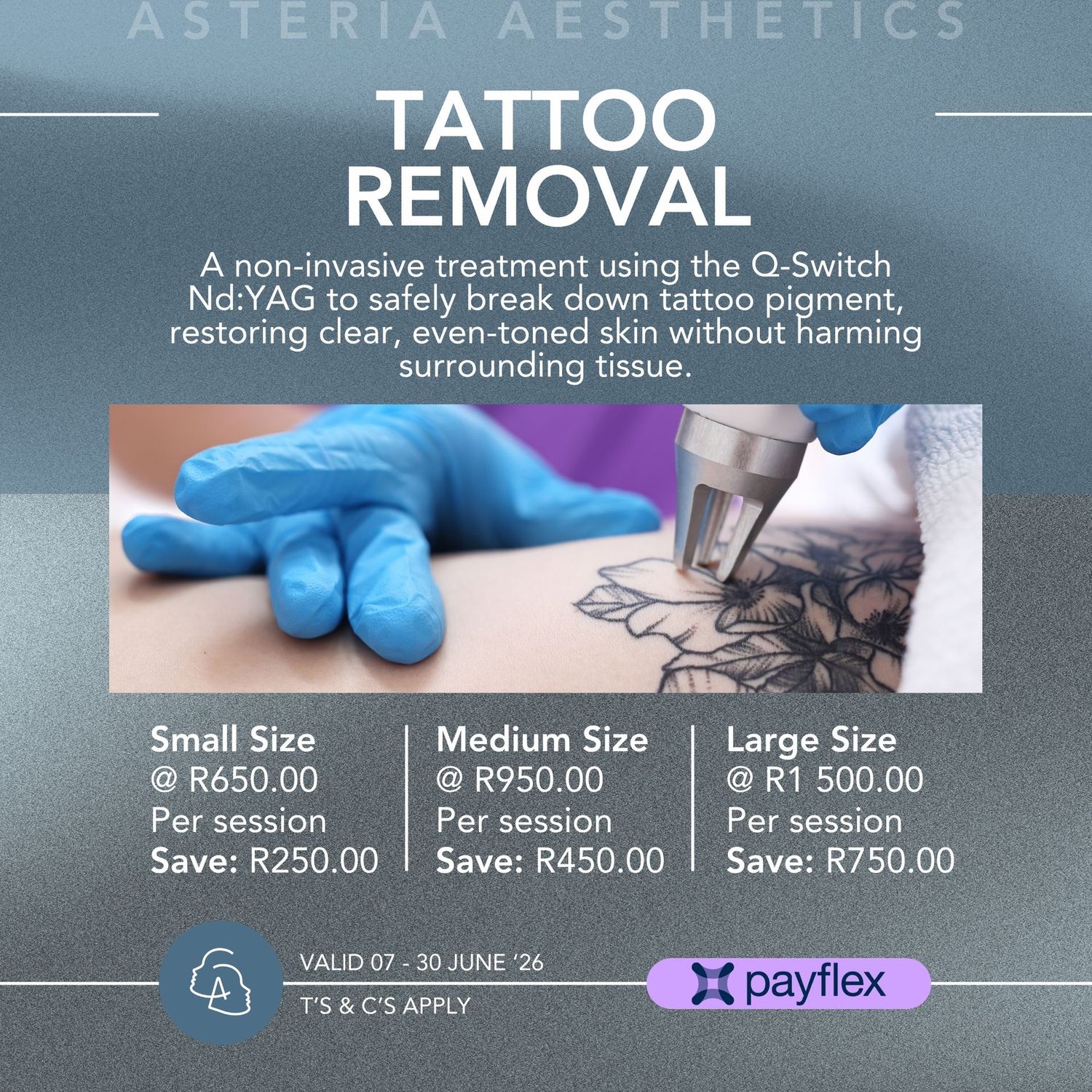 Tattoo Removal Small