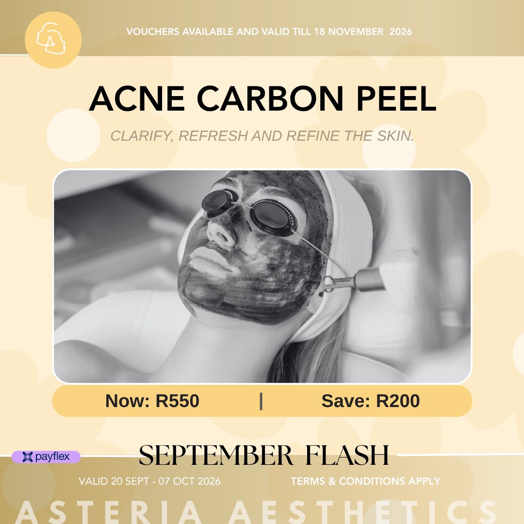 Acne Carbon peel