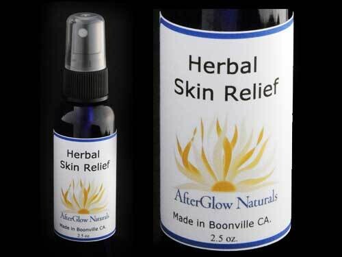 Herbal Skin Relief