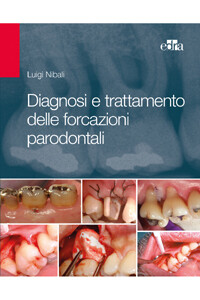 Luigi Nibali, Diagnosi e trattamento delle forcazioni parodontali.