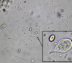 Giardia Test Kits
