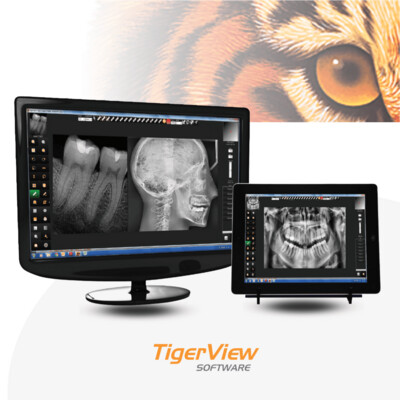 TigerView Software