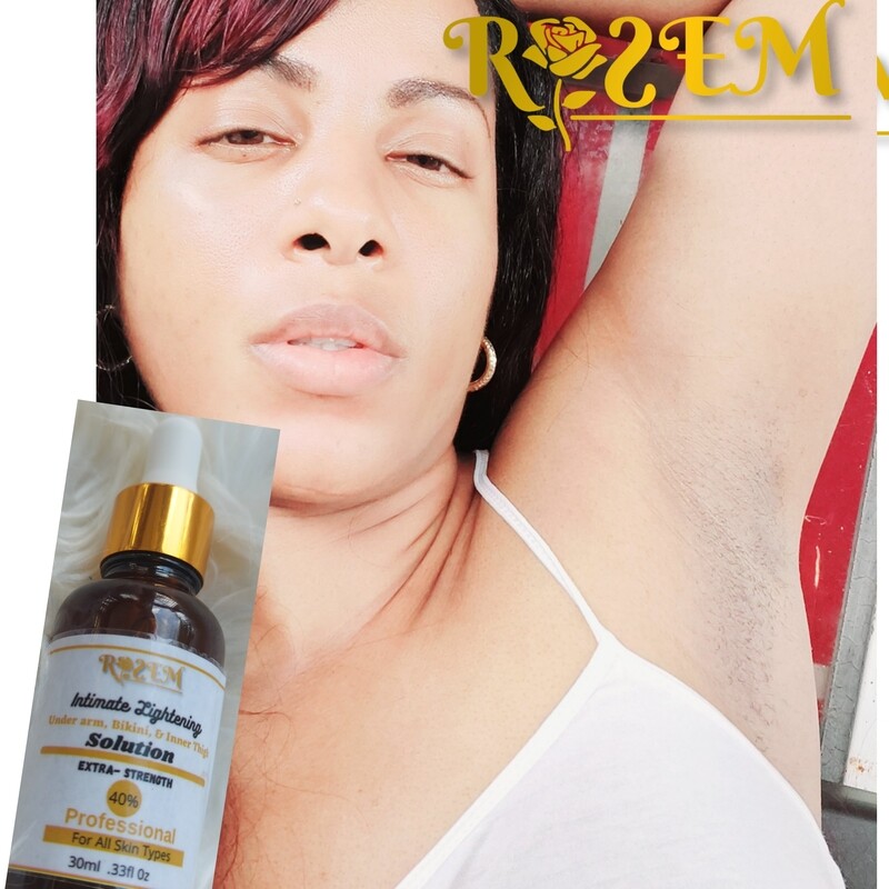 Intimate Lightening &amp; Scar Removal Serum