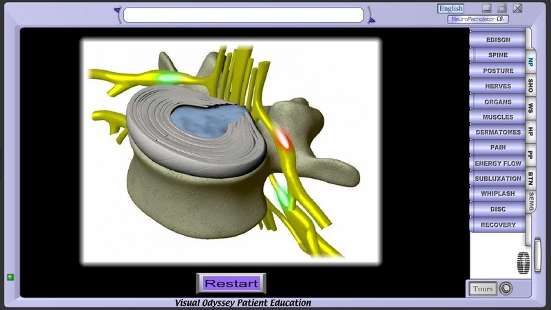 Neuropatholator Touch - Bronze