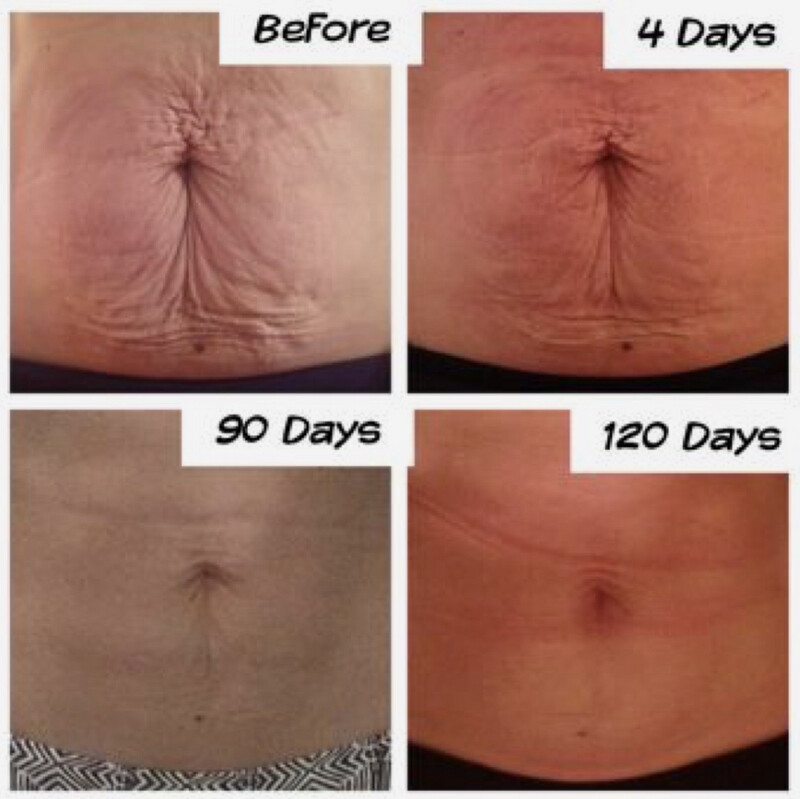 Body Shaping Gel (to Be Used With the Facial Spa)