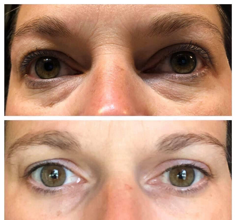 Ideal Eyes