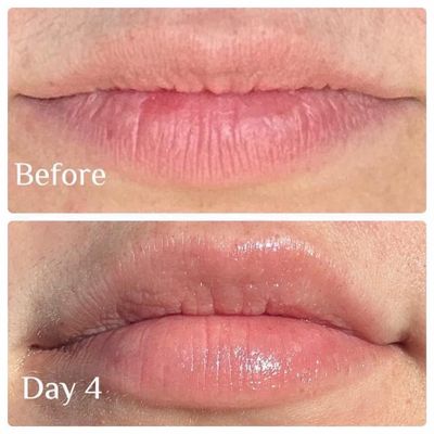 NEW Raspberry Peptide Pout