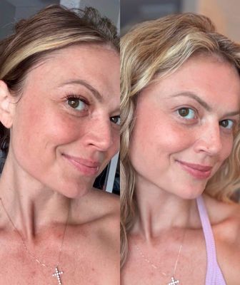 GloPro Microneedling + Retinol Peptide + Free Line Corrector