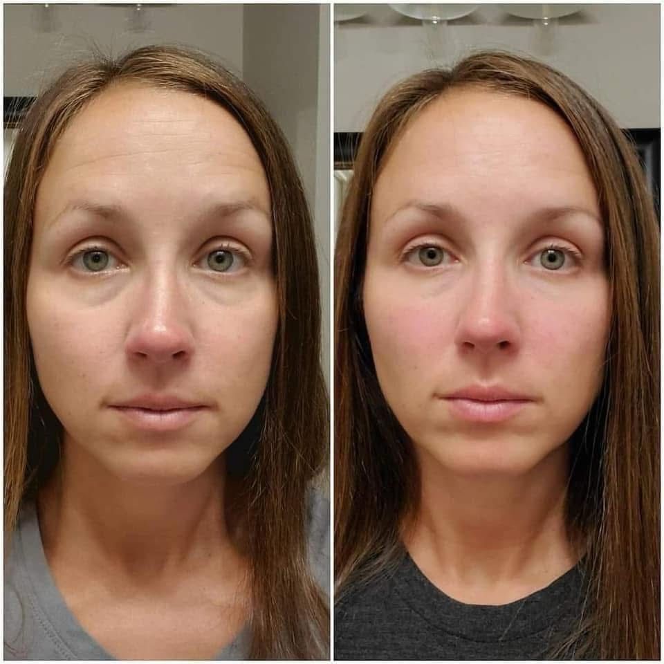 Puffy Eye Cream