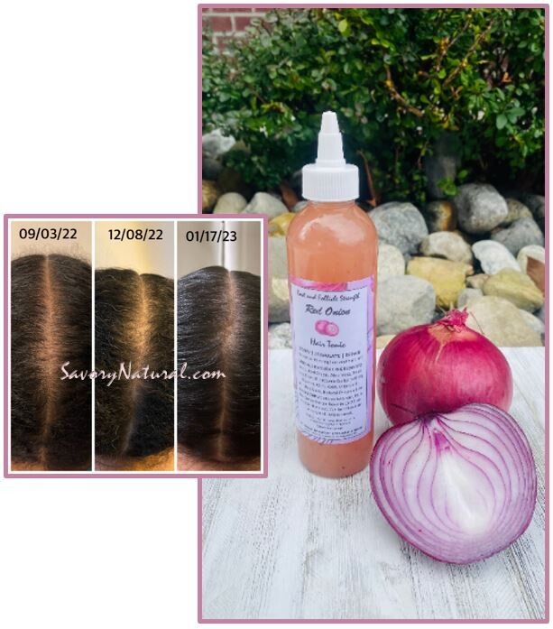 Red Onion Hair Tonic | Root &amp; Follicle Strength and Repair 8oz