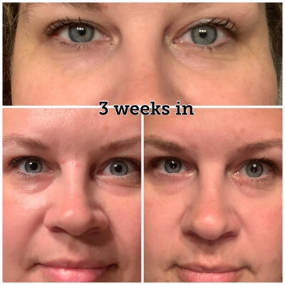Ideal Eyes Cream