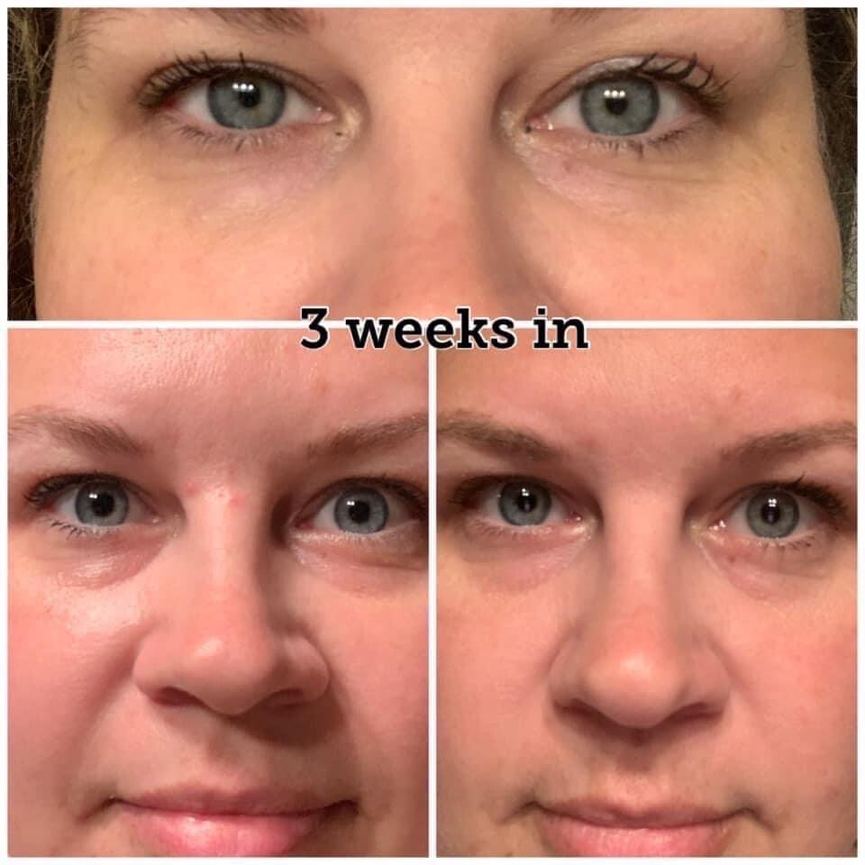 Ideal Eyes Cream
