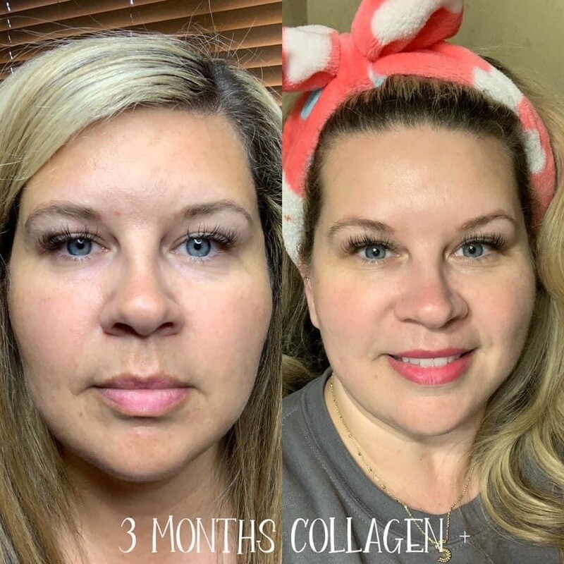 Collagen (Liquid Box of 30 pouches)