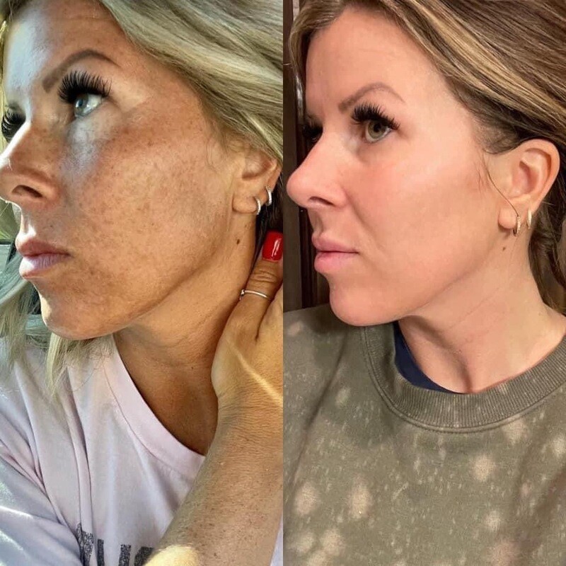 VIT C Face Wash