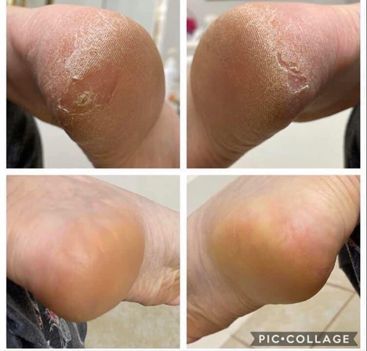 Sole Solutions