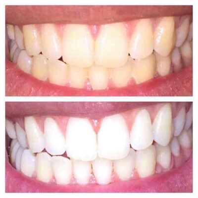 Whitening Toothpaste