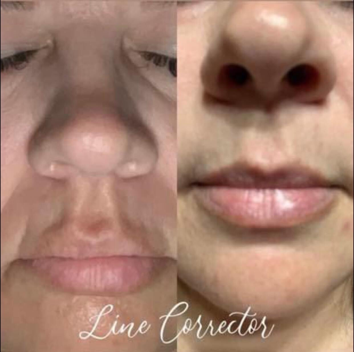 Line Corrector