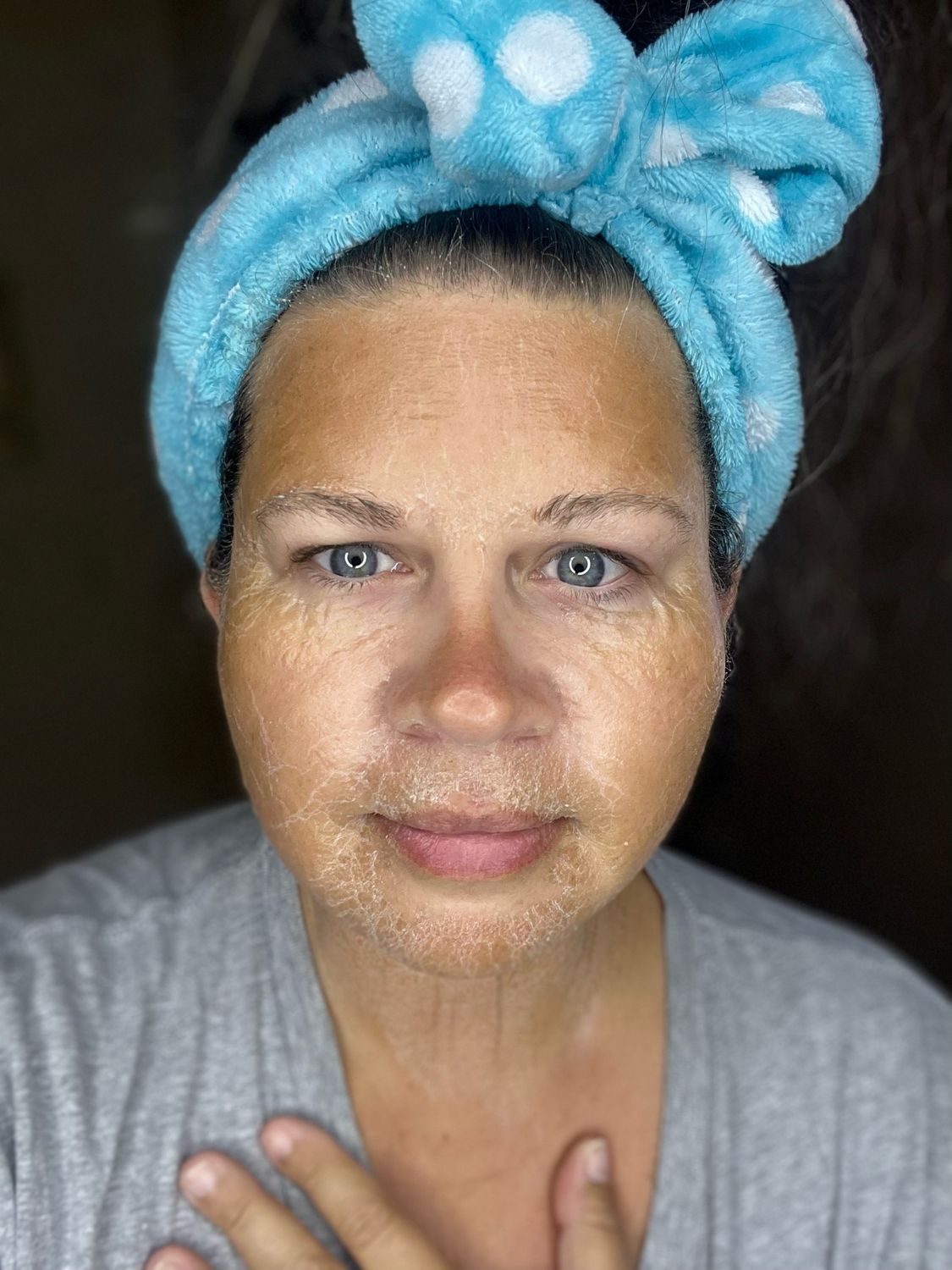 Face Lift Kit