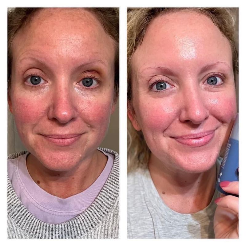 Retinol Peptides THREE PACK