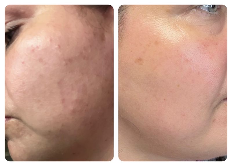 RETINOL PEPTIDES