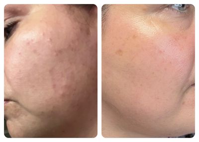 RETINOL PEPTIDES