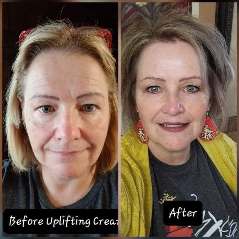 Uplifting Cream (My glp neck cream)