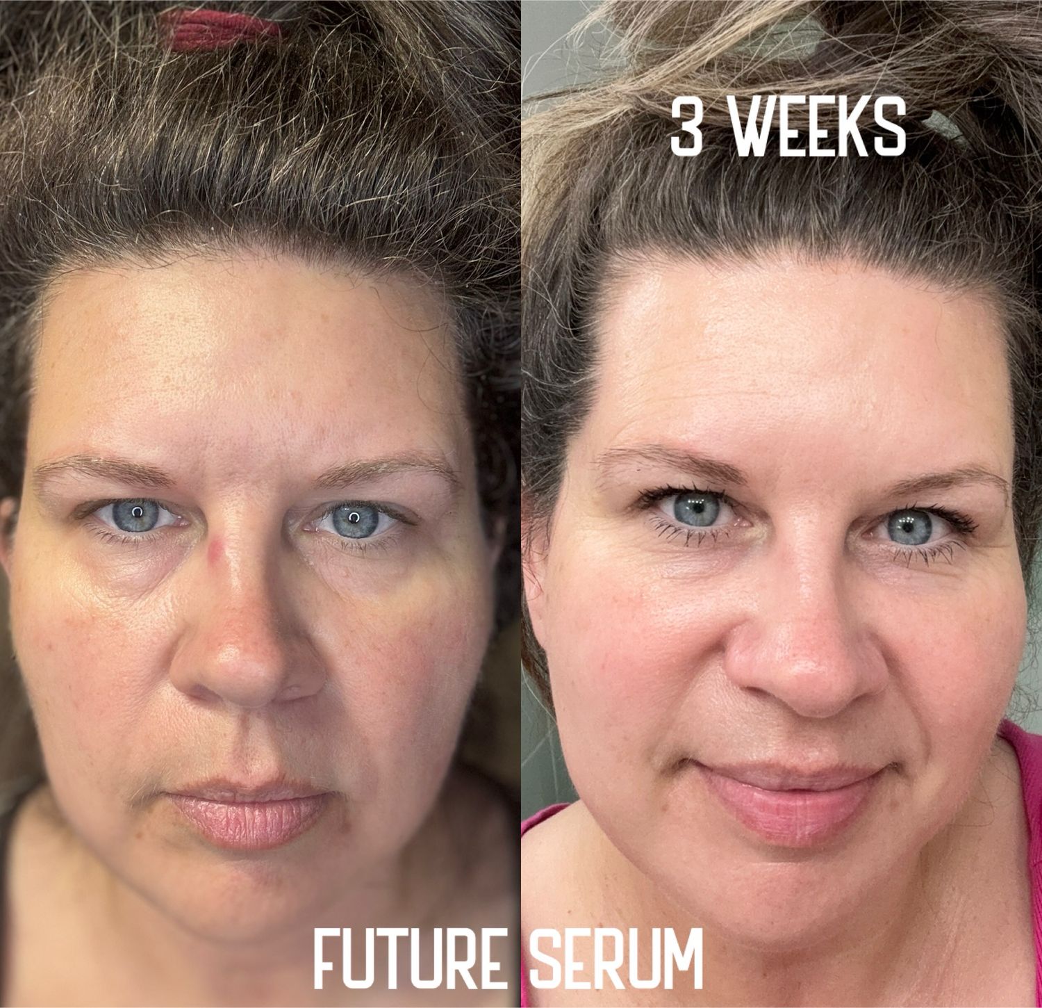 Future Serum 🦄