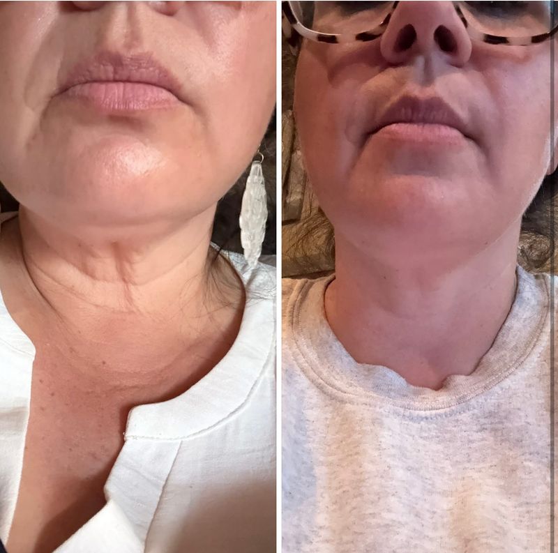 My glp neck cream (Uplifting Cream)