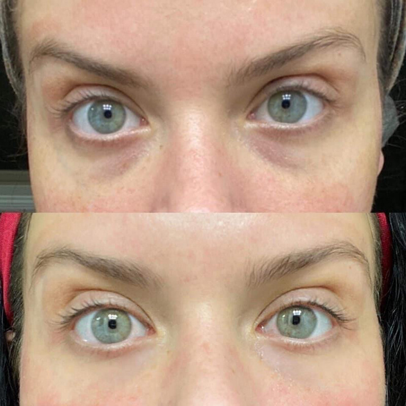 Ideal Eyes