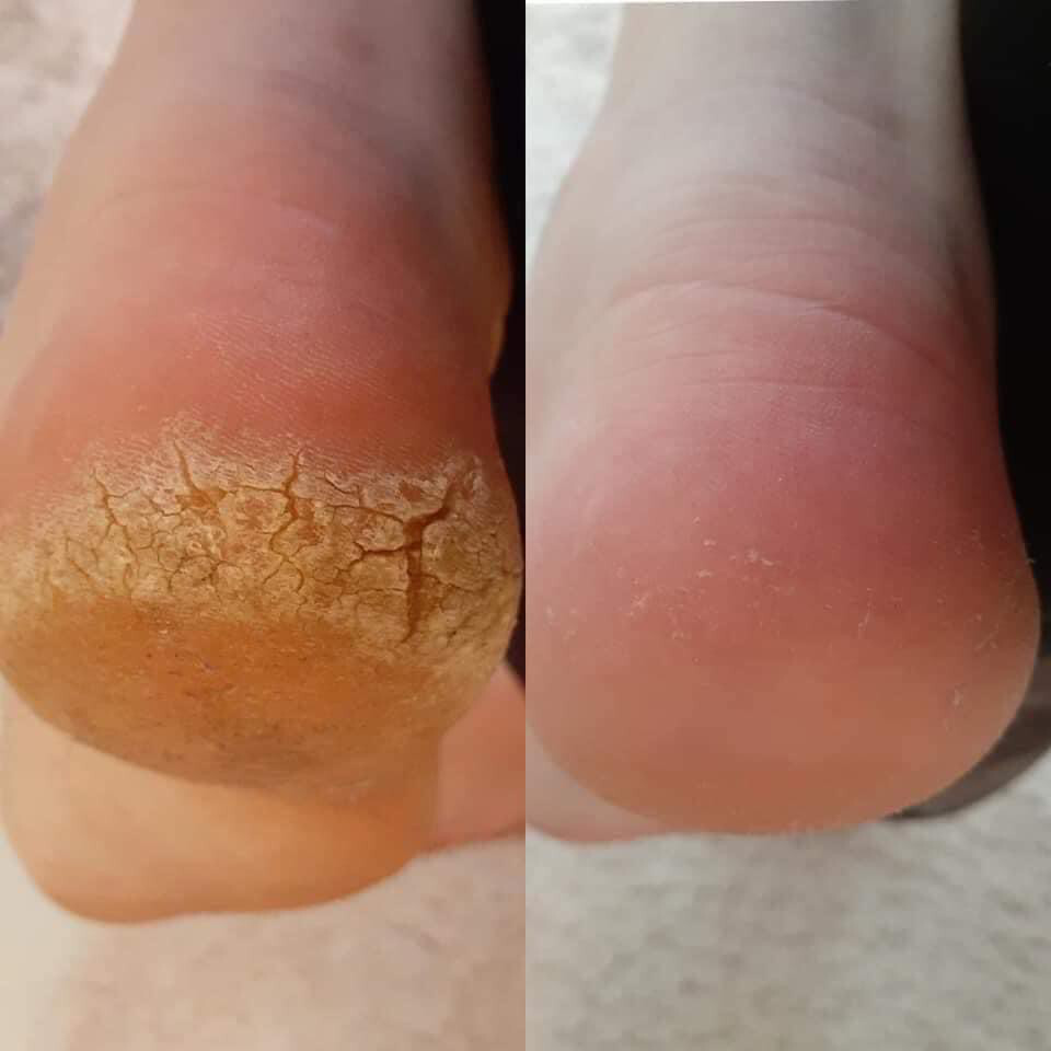 Sole Solutions