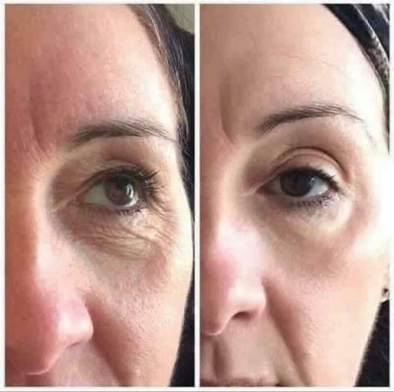 Anti Aging Serum