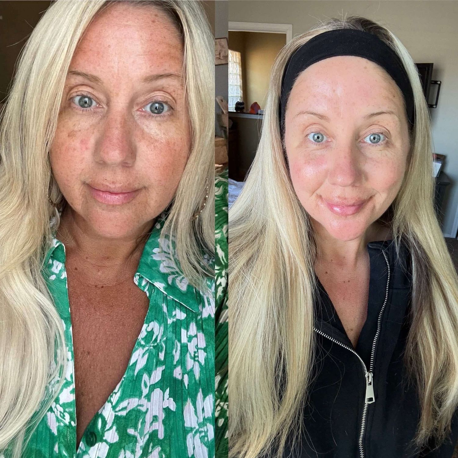 Retinol