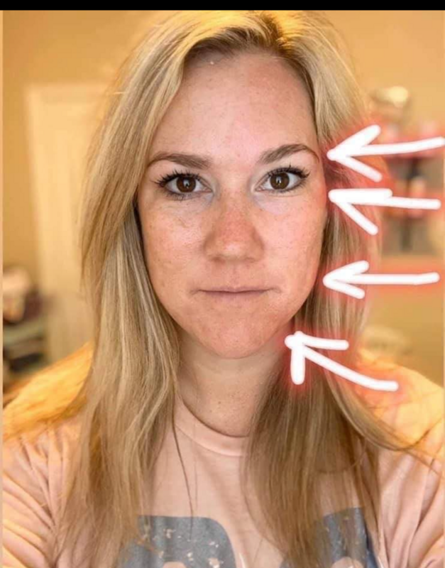 Face Lift Kit