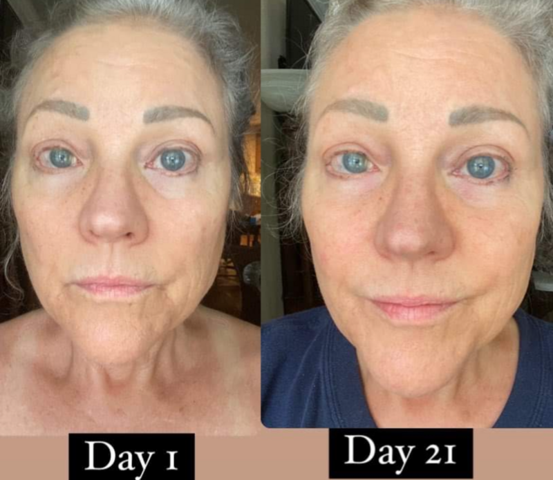 Beauty Focus™ Collagen+ 
