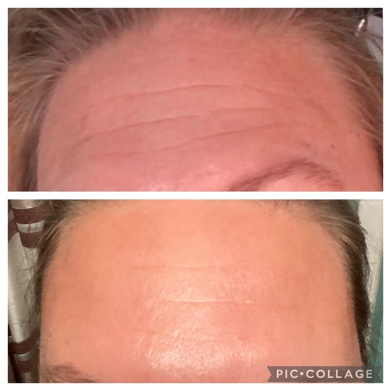 Line Corrector
