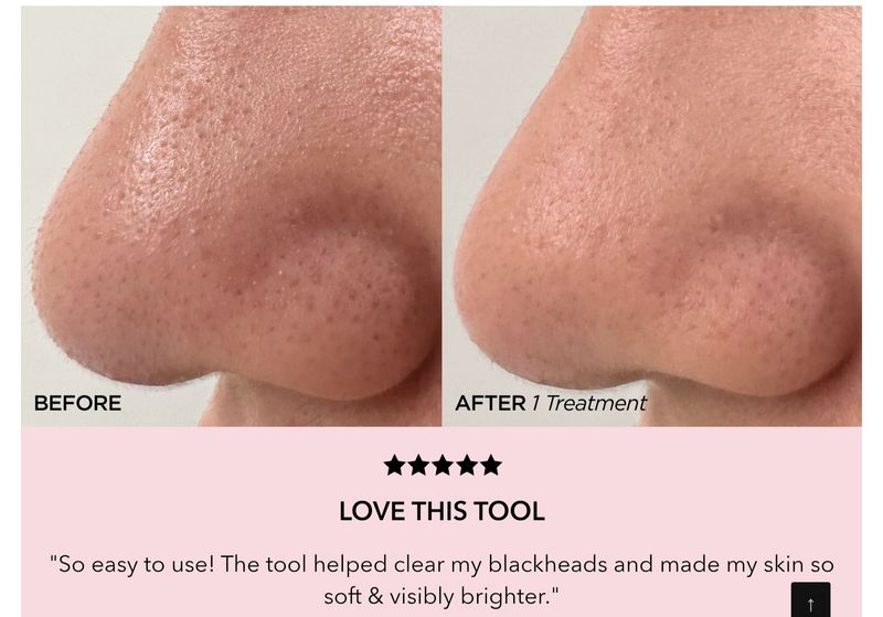 GlowFacial