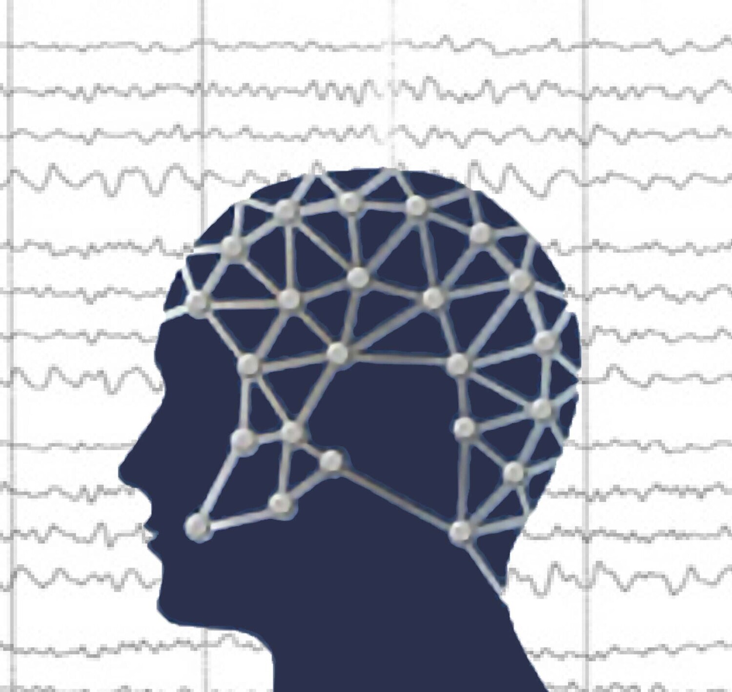 BFSA EEG/QEEG Course: Full payment