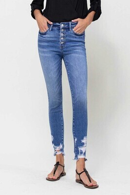 Vervet Button Fly Medium Wash High Rise Skinny Fit With Distressed Hem
