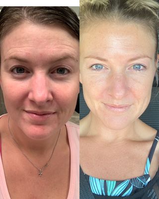 Powder Collagen Citrus