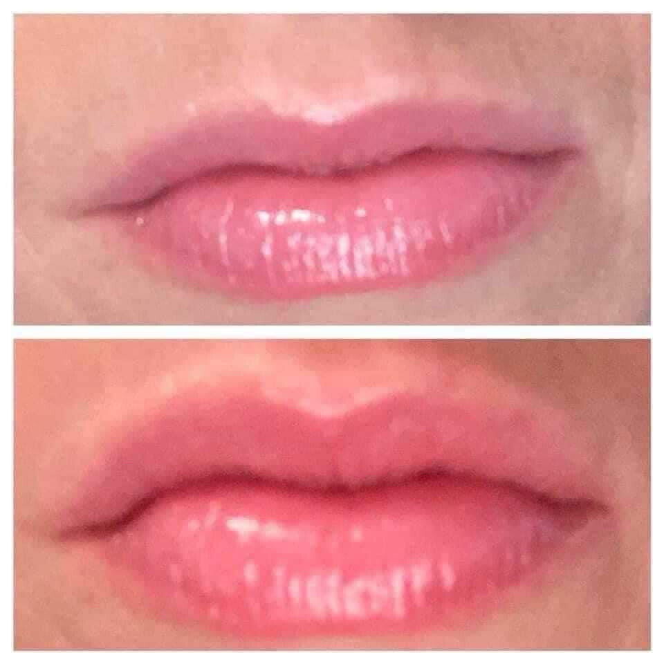 Lip Plumper