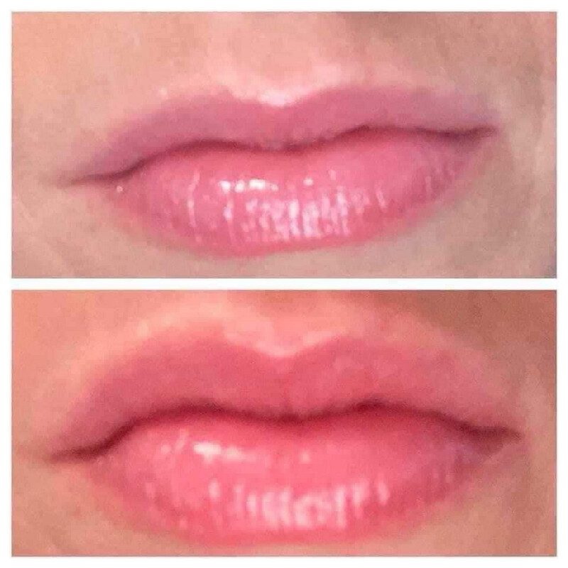Lip Plumper