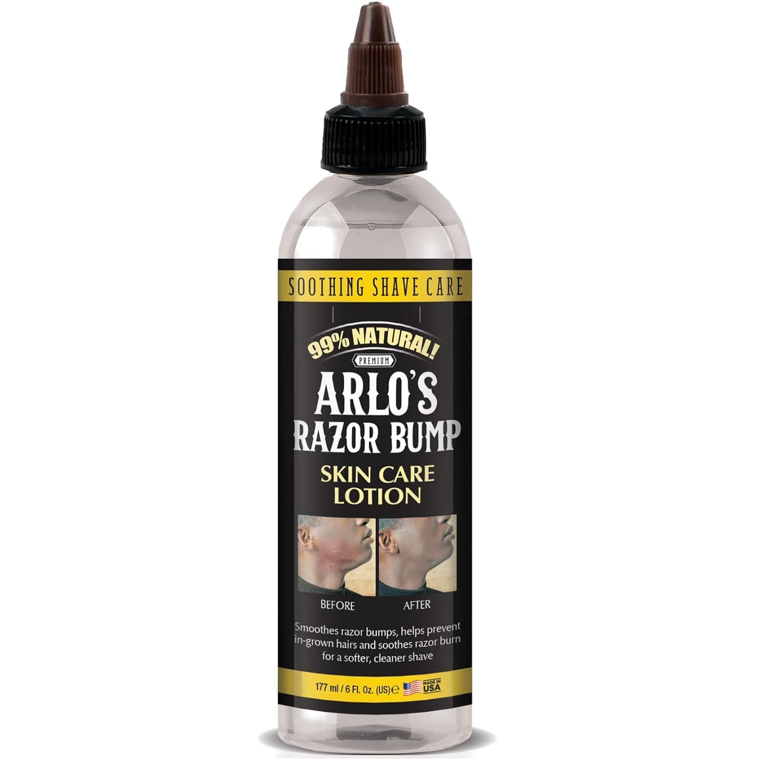 ARLO&#39;S RAZOR BUMP SKIN CARE LOTION 177
