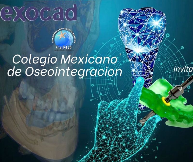 DIPLOMADO IMPLANTOLOGÍA DIGITAL EXOCAD Con Valor curricular