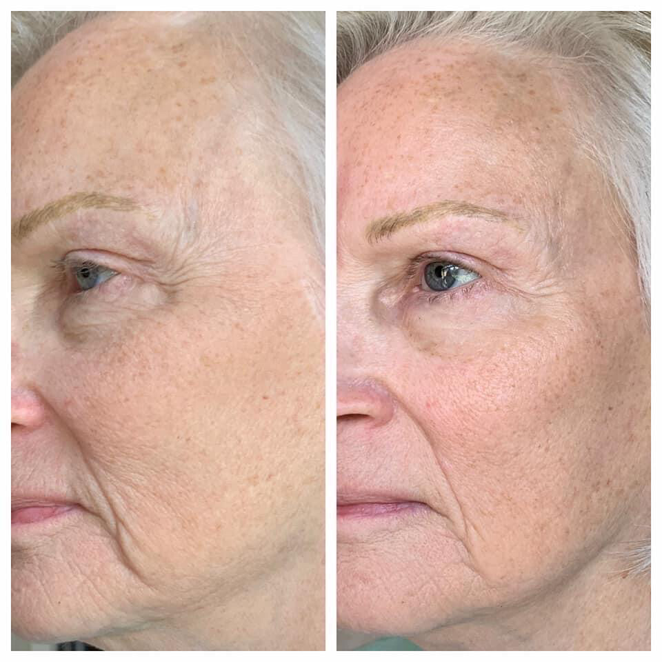 Uplifting Cream Refill