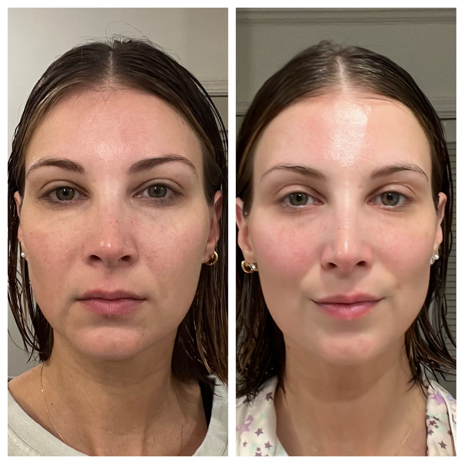 Peptide Retinol