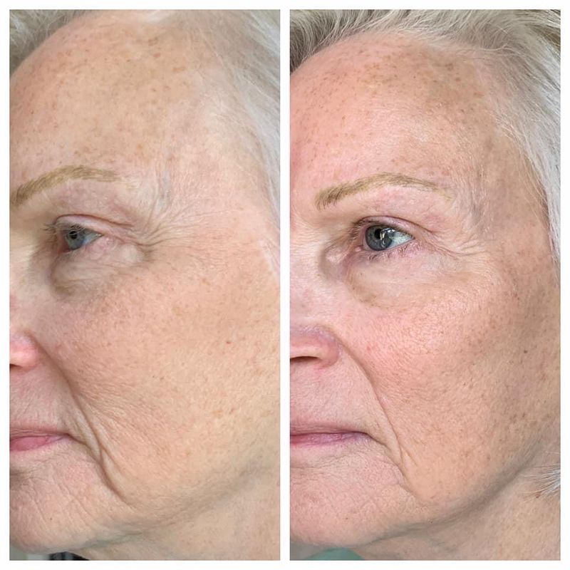 Uplifting Cream Refill