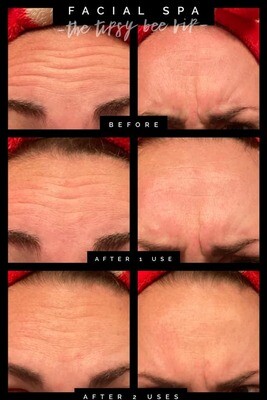 Facial Spa - aka "Wrinkle Iron"
